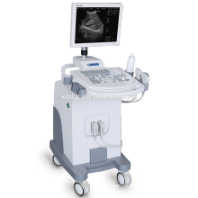 DW-370 2017 New design medical equipment ultrasound machine